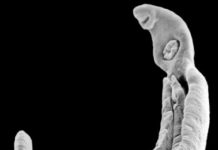 Pesquisa apontam potencial de anti-inflamatório usado contra cólica menstrual no tratamento de esquistossomose